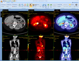 PET CT fusion visualization