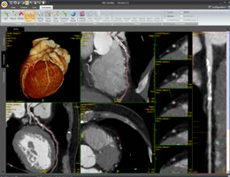 Fully automatic analysis of cardiac CT
